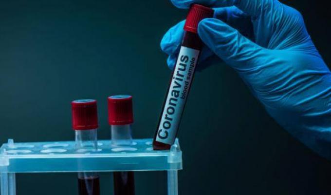 За добу в області зафіксовано 181 новий випадок COVID-19