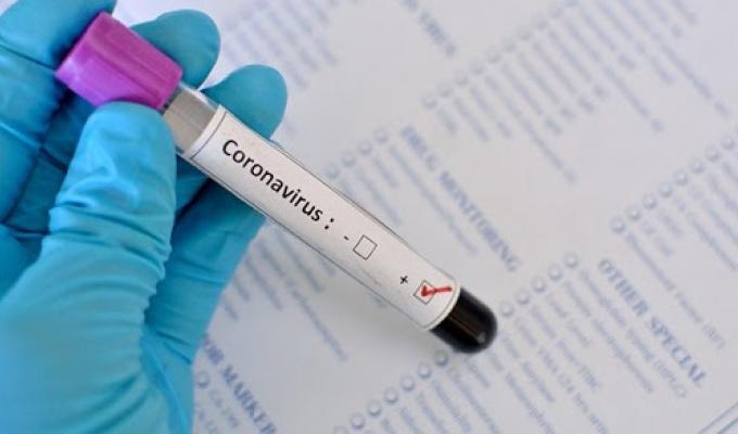 Виявлено випадок захворюваності на COVID-19 в м. Кремінна
