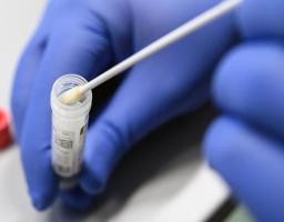 На Луганщині лабораторно підтверджено 38 нових випадків COVID-19. Від ускладнень померли ще три особи