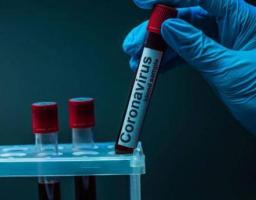 На Луганщині лабораторно підтверджено 25 нових випадків COVID-19 
