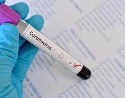 Виявлено випадок захворюваності на COVID-19 в м. Кремінна